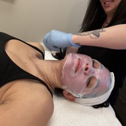 Skinspirit - Denver Tech Center - Facial cooling mask after treatment