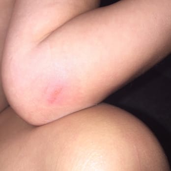 Pump It Up - 3 year old burned on the way down the slide like me. - Trampoline Parks Near Me - San Jose, California Pump It Up - 3 year old burned on the way down the slide like me. - Trampoline Parks Near Me - San Jose, California