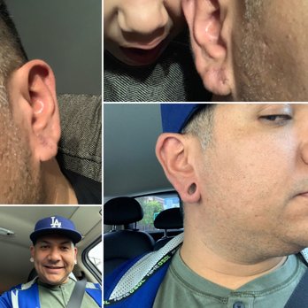 Burbank Plastic Surgery - Earlobe repair - Cosmetic Surgeons Near Me - Burbank, California Burbank Plastic Surgery - Earlobe repair - Cosmetic Surgeons Near Me - Burbank, California