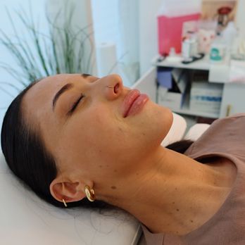 Botox & Beyond Med Spa - Amazing natural result for my client after dermal filler injection for her lips. - Medical Spas Near Me - San Diego, California Botox & Beyond Med Spa - Amazing natural result for my client after dermal filler injection for her lips. - Medical Spas Near Me - San Diego, California