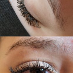 ELVA Aesthetics - Hybrid Set