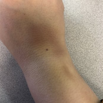 Kool Dentistry - Kicked out of the office and left bruised! - Cosmetic Dentists Near Me - Glendale, California Kool Dentistry - Kicked out of the office and left bruised! - Cosmetic Dentists Near Me - Glendale, California