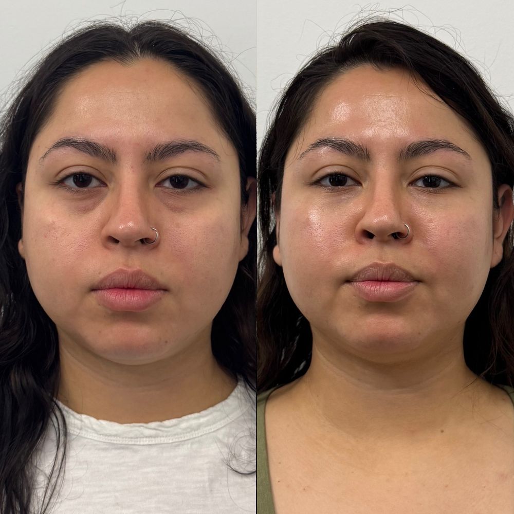 Lifted Aesthetics Charlotte Logo