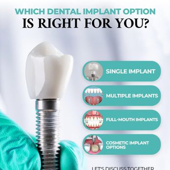 Verdugo Hills Dental Group - Single Implant
Multiple Implants
Full-Mouth Implants
Cosmetic Implant Options - General Dentistry Near Me - Glendale, California Verdugo Hills Dental Group - Single Implant
Multiple Implants
Full-Mouth Implants
Cosmetic Implant Options - General Dentistry Near Me - Glendale, California