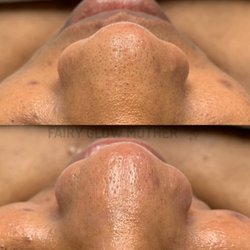 Glowdega - Essential Glow Customized Facial