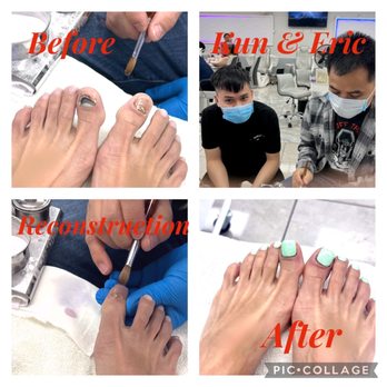 Happiness Nails Spa - Reconstruction of Runners toes - Nail Salons Near Me - Porterville, California Happiness Nails Spa - Reconstruction of Runners toes - Nail Salons Near Me - Porterville, California