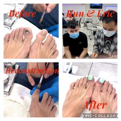 Happiness Nails Spa - Reconstruction of Runners toes