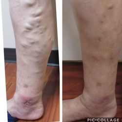 Valley Vein Health Center