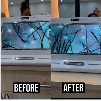Noble Nail Studio - Scalp analysis before my treatment and after my treatment - Nail Salons Near Me - Cerritos, California