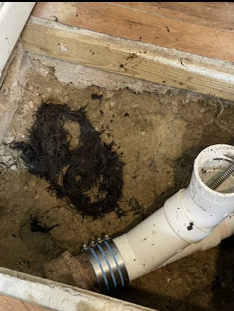 Slide of Drain Pains