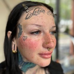 The Micro Clinics - Freckle Tattoo