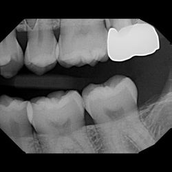 Dunn Dental
