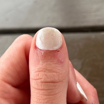 Ocean Nails & Spa - This is my thumb, the finger that bled. - Nail Salons Near Me - Bentonville, Arkansas Ocean Nails & Spa - This is my thumb, the finger that bled. - Nail Salons Near Me - Bentonville, Arkansas