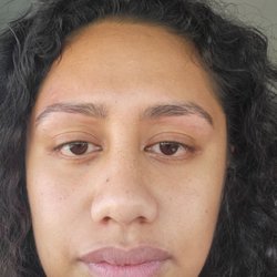 Anu Threading & Beauty Center - Red, swollen skin. Bleeding in several areas, used warm compress 10 mins to alleviate it.