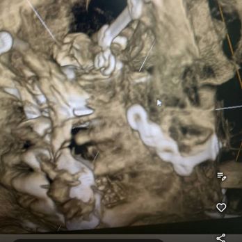 Hogan Smith Law - This is some of my face trauma - Personal Injury Law Near Me - Orlando, Florida Hogan Smith Law - This is some of my face trauma - Personal Injury Law Near Me - Orlando, Florida