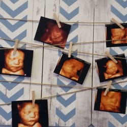 Prenatal Peek - West Covina