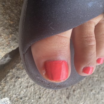 Cute Nails& Spa - Cut toe from pedicure - Waxing Near Me - Lake Geneva, Wisconsin