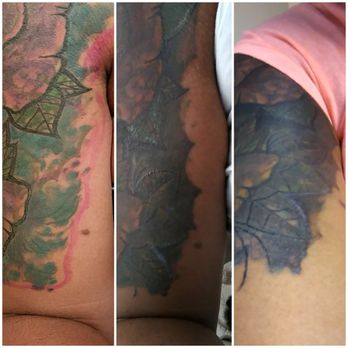 Clover City Ink - I was charged $550. It's very upsetting being that the damage is permanent, and I paid so much money - Piercing Near Me - Stone Mountain, Georgia