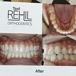 Rehil Orthodontics - After