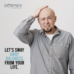 Downey Hair Loss Solutions Scalp Micropigmentation