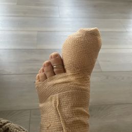 Toe nail fungus from this shop/ nail surgery removal. So painful! Toe nail fungus from this shop/ nail surgery removal. So painful!