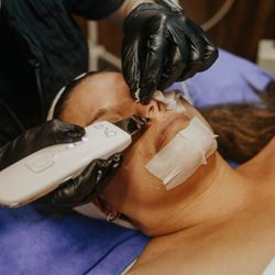 Blue Birdie Beauty - Ultrasonic, almost painless extractions. All bespoke facials include extractions if requested or noticed during the skin analysis.