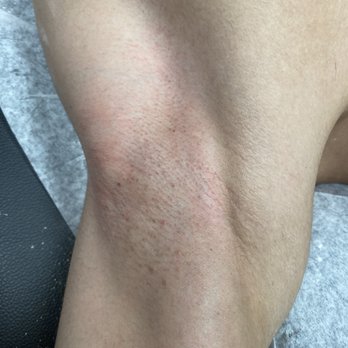 The Serial Waxer Co. - Armpits wax every 5 weeks. - Waxing Near Me - Tracy, California