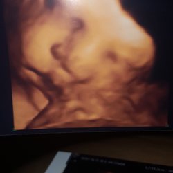 Houston Babies 4d Ultrasound - My baby girl Skylar