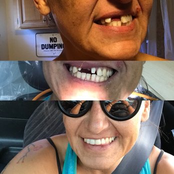 Citrus Heights Dental - General Dentistry Near Me - Citrus Heights, California