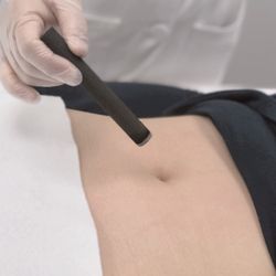Join Acupuncture & Herbal Medicine - Moxibustion