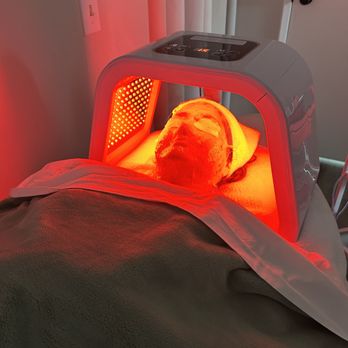 Glow Up Skincare - Microdermabrasion + LED + Egyptian Rose Jelly Mask = glow, calm, and hydration. No needles, just radiant skin! - Estheticians Near Me Glow Up Skincare - Microdermabrasion + LED + Egyptian Rose Jelly Mask = glow, calm, and hydration. No needles, just radiant skin! - Estheticians Near Me