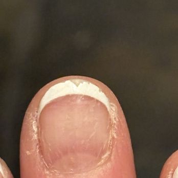 Paradise Nails & Spa - Five days after my $40 French manicure that was rushed and had zero topcoat - Nail Salons Near Me - Colorado Springs, Colorado Paradise Nails & Spa - Five days after my $40 French manicure that was rushed and had zero topcoat - Nail Salons Near Me - Colorado Springs, Colorado