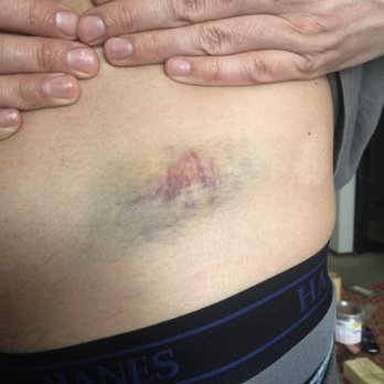Tom's Peacock Bar & Grill - Bouncers beating up paying patron. - Bars Near Me - Corvallis, Oregon
