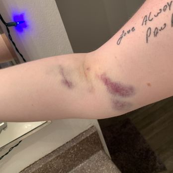 Biolife Plasma Services 12 Photos 39 Reviews Blood Plasma Donation Centers 3455 Quail Creek Dr Denton Tx Phone Number