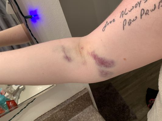 Biolife Plasma Services 3455 Quail Creek Dr Denton Tx Blood Banks Centers Mapquest