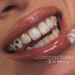 Maciaas Beauty - Tooth gems and a chandelier