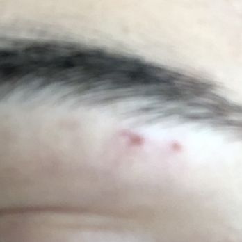 Shapes Brow Bar - Both brows were nicked. - Makeup Artists Near Me - Burbank, California