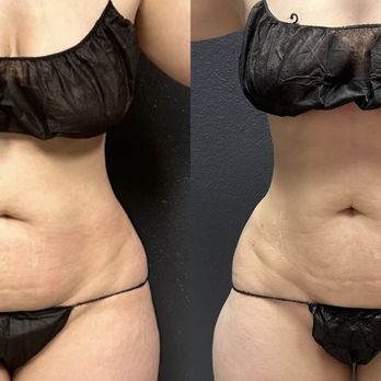 Grace MedSpa & Body Solutions - Body Contouring Near Me - Austin, Texas Grace MedSpa & Body Solutions - Body Contouring Near Me - Austin, Texas