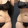 Photo of Grace MedSpa & Body Solutions