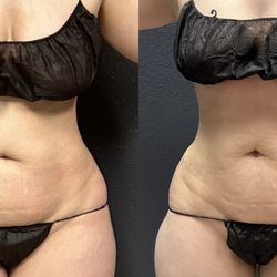 Grace MedSpa & Body Solutions