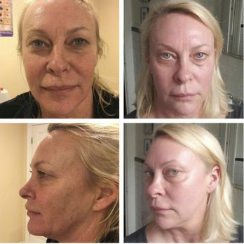 Queen Beauty - skin Brightening Treatment - Medical Spas Near Me - San Diego, California Queen Beauty - skin Brightening Treatment - Medical Spas Near Me - San Diego, California