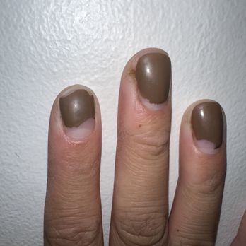 Acryliq Nails - Side of fingers cut and this was five days after getting my Nails done. - Nail Salons Near Me - Canoga Park, California