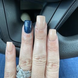 Left hand uneven nails. Can you see how they arn't even straight. Left hand uneven nails. Can you see how they arn't even straight.