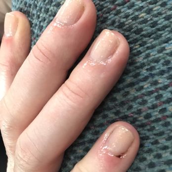 Nail Splash - bloody pinky. they had to use some sort of powder to stop the bleeding - Nail Salons Near Me - Willingboro, New Jersey