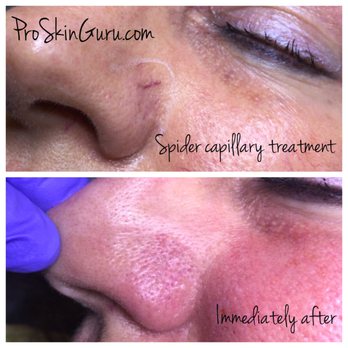Pro Skin Studio - Skin Care Near Me - Middlebury, Vermont Pro Skin Studio - Skin Care Near Me - Middlebury, Vermont