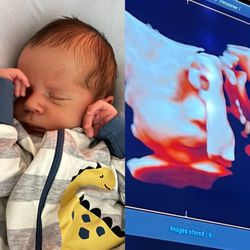 Forever Yours Ultrasound - His pose is exactly the same as it was in the womb.