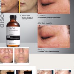 Skinology by Arpana Purani - Get Ready for Fall Peel Sale Event.   October 2-13 th.   Free Goodie  bags customized to you