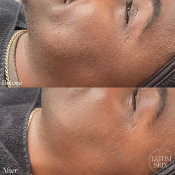 Tatum Skin - Skin Care Near Me - Inglewood, California Tatum Skin - Skin Care Near Me - Inglewood, California