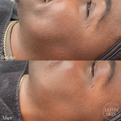 Tatum Skin