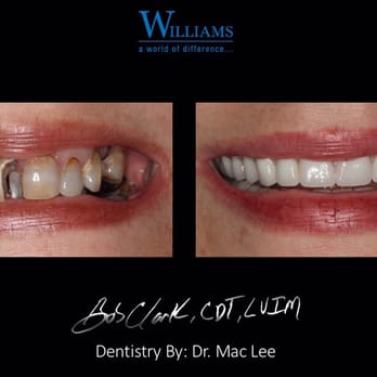 Williams Dental Lab - General Dentistry Near Me - Gilroy, California